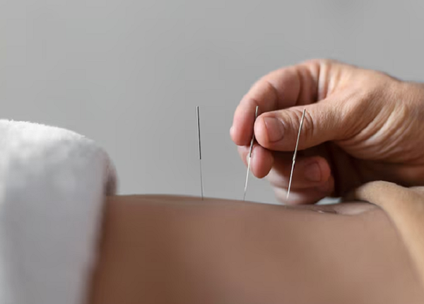 Phương pháp Đông y hỗ trợ cải thiện triệu chứng viêm khớp dạng thấp